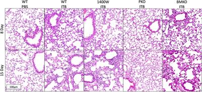 Cell Origin and iNOS Function Are Critical to Macrophage Activation Following Acute Lung Injury